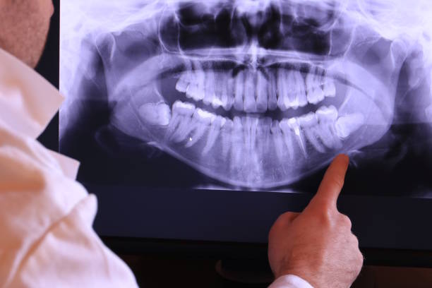 Best Emergency Root Canal Treatment in Murphy, NC